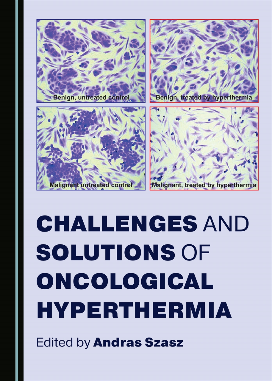 Challanges and Solutions of Oncological Hyperthermia book cover